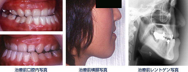 治療前写真