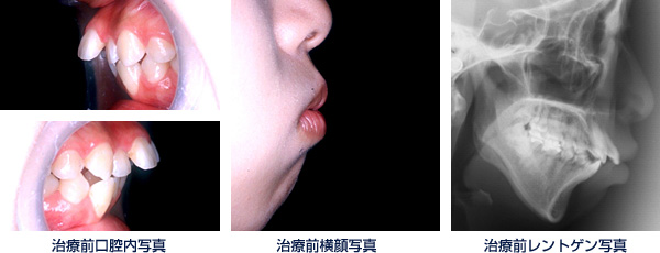 治療前写真