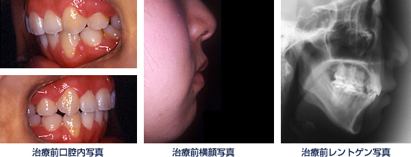 治療後写真